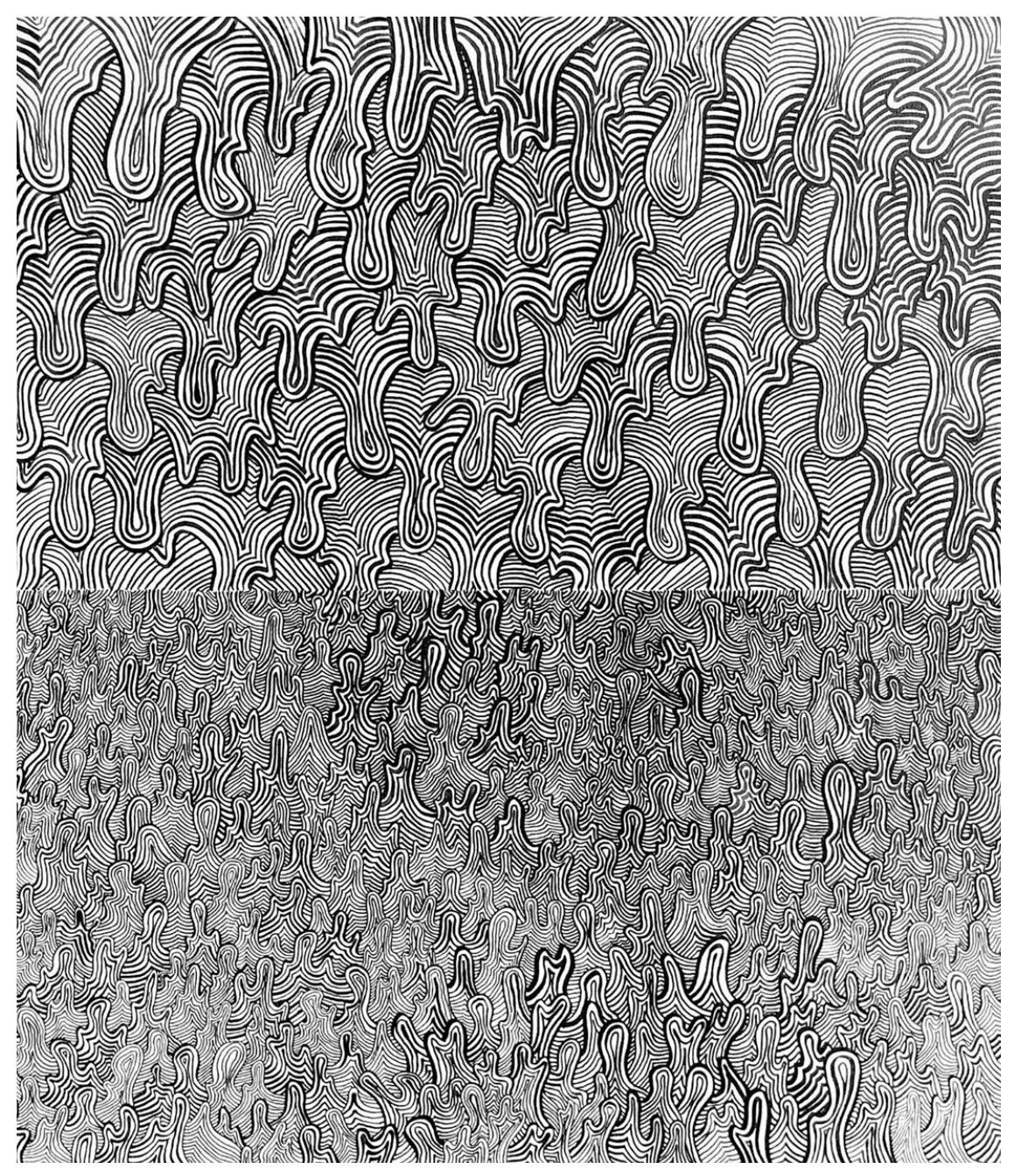 Migraine